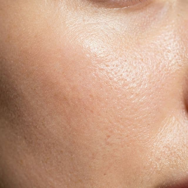 Clinical facial treatment process and results - Image 1